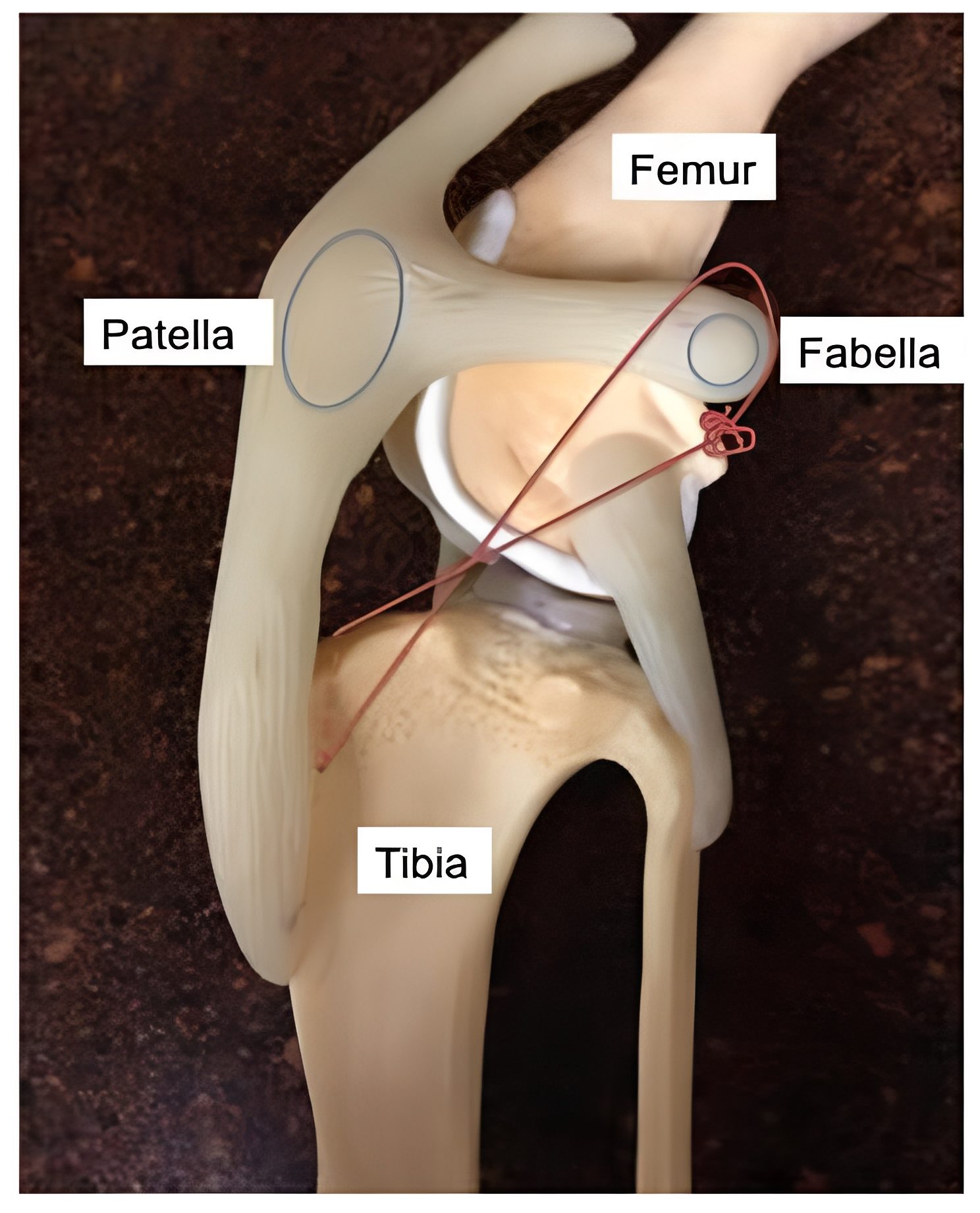 Labeled diagram of human knee structure Labeled diagram of human knee structure